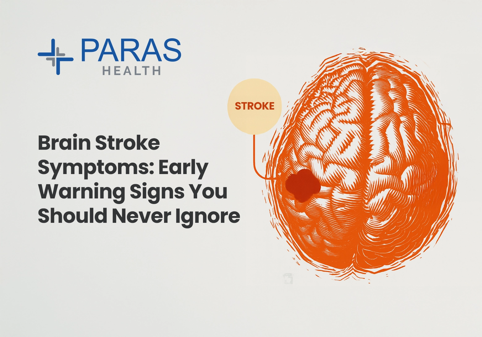 Brain Stroke Symptoms: Early Warning Signs You Should Never Ignore